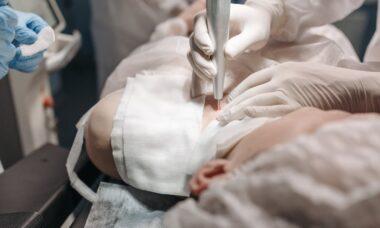 découvrez les dernières tendances en chirurgie plastique, des procédures esthétiques aux techniques innovantes, pour sublimer votre apparence et améliorer votre confiance en soi. informez-vous sur les consultations, les interventions et les résultats attendus.